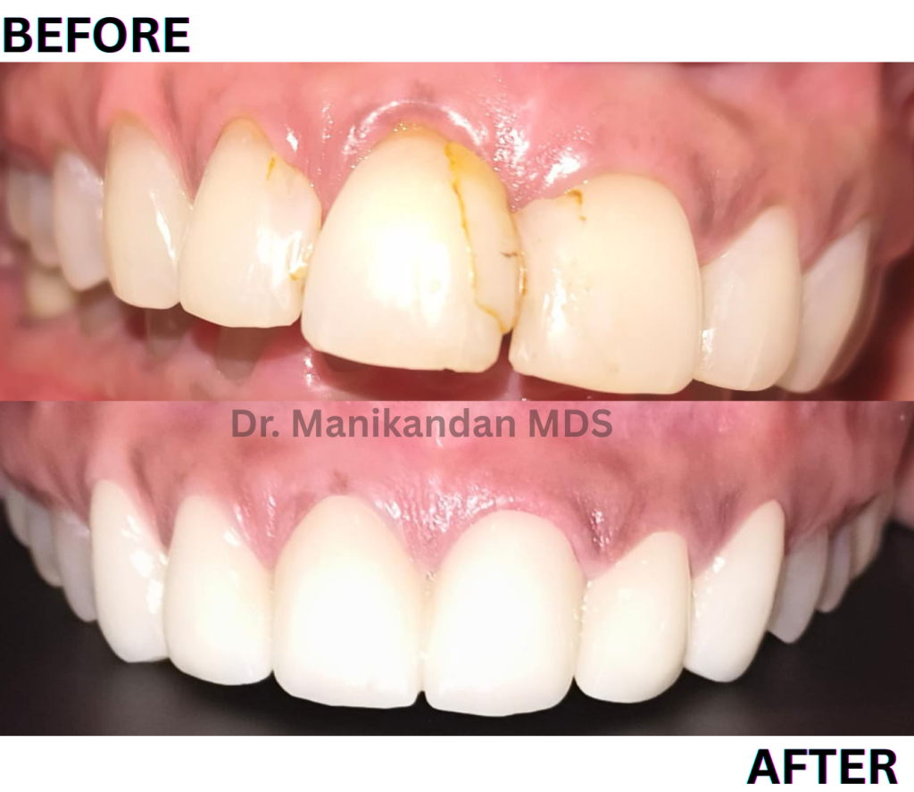 Minimalist Pancake Day Mood Photo Collage (12)