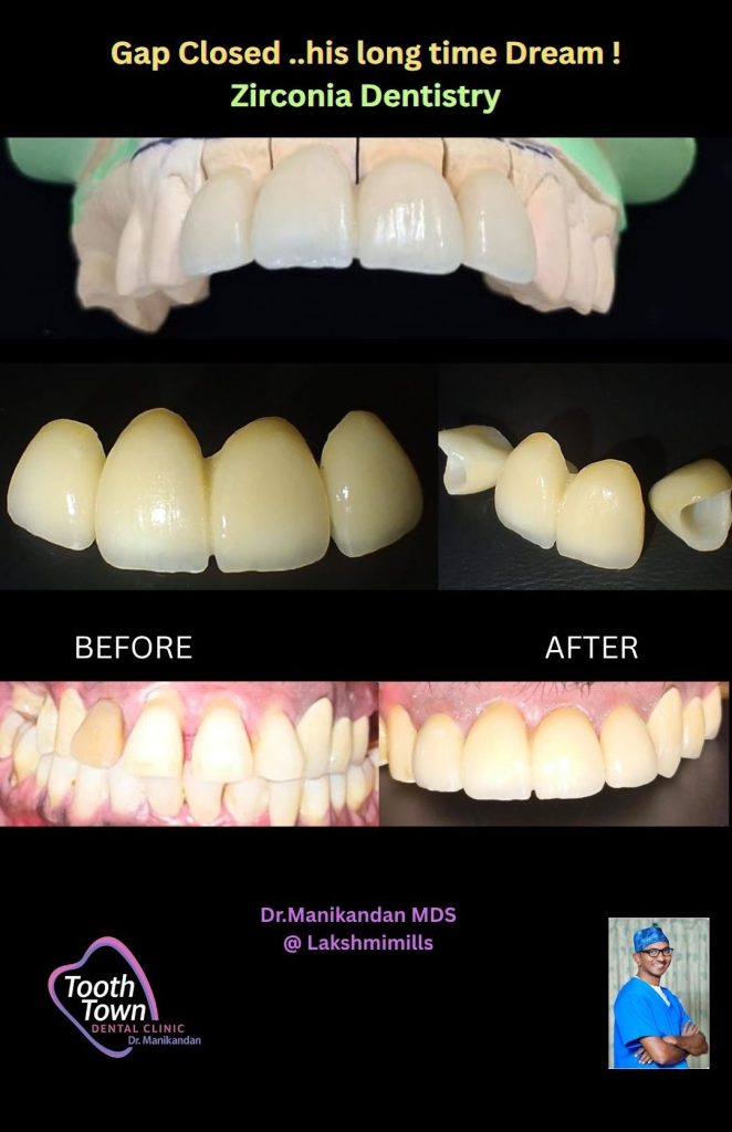 Neon Green and Black Yes or No Tiktok Background (5)