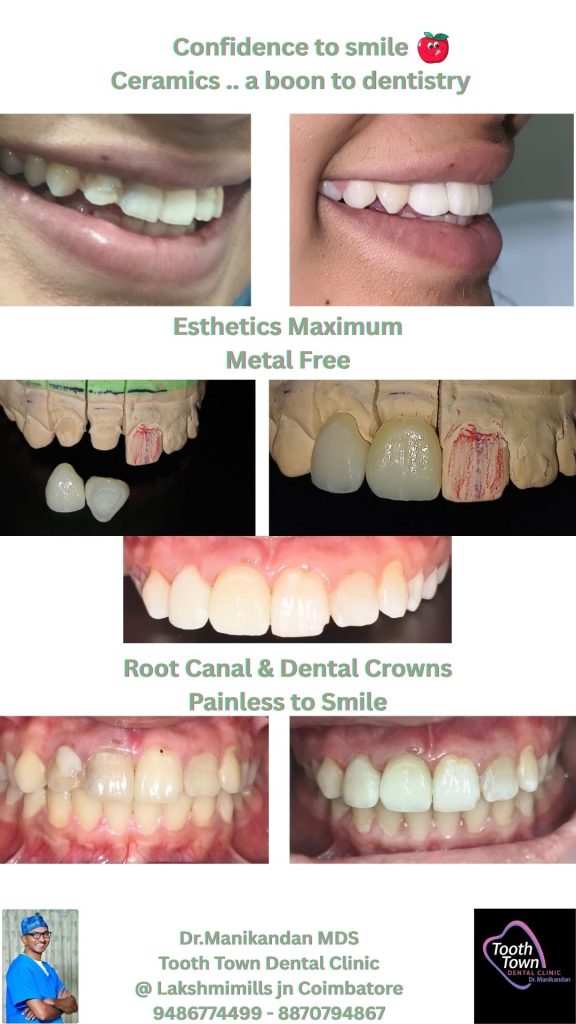 Neutral Black And White Minimalist Teeth Care Photo Collage Instagram Story