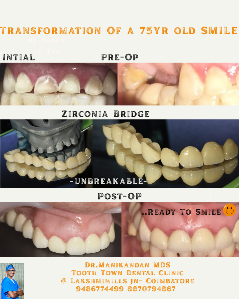 Neutral Minimalist Scrapbook Photo Dump Instagram Post (2)