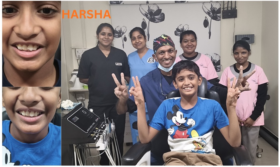 peadiatric dentistry Coimbatore-tooth town dental clinic